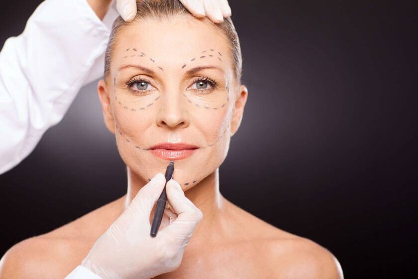 Woman with surgery markings on face